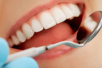 合肥牙齿美白如何选择？