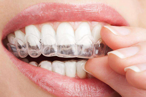 合肥隐形矫正牙齿多少钱？