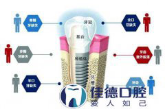 合肥牙科医院种植牙多少钱？