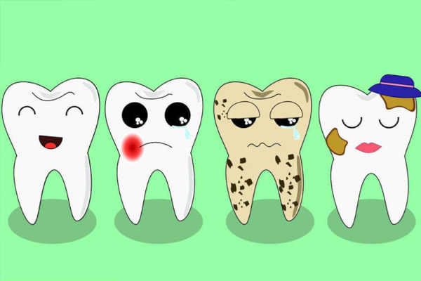 合肥蛀牙治疗多少钱？