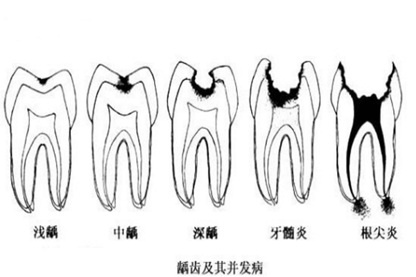 补牙