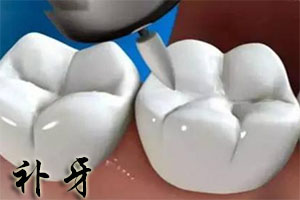 牙有龋坏有时痛的厉害是怎么回事