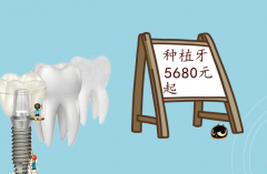 合肥种植牙齿大概要多少钱？