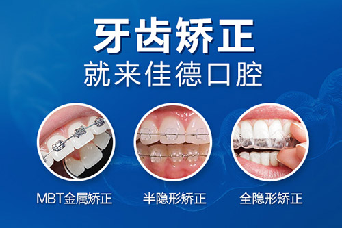 牙齿矫正价格