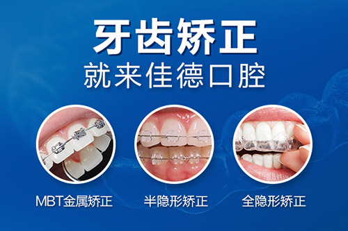 合肥牙齿矫正哪个医院好-正畸牙科建议？