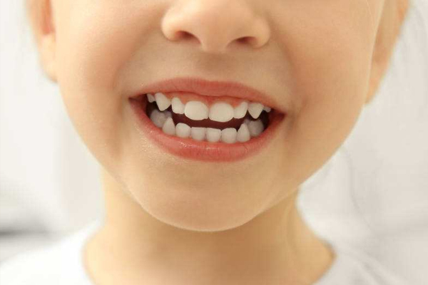 儿童为什么会蛀牙呢？
