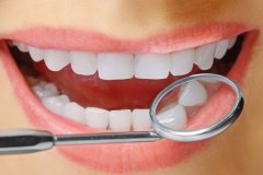  四环素沉着牙怎么治疗？