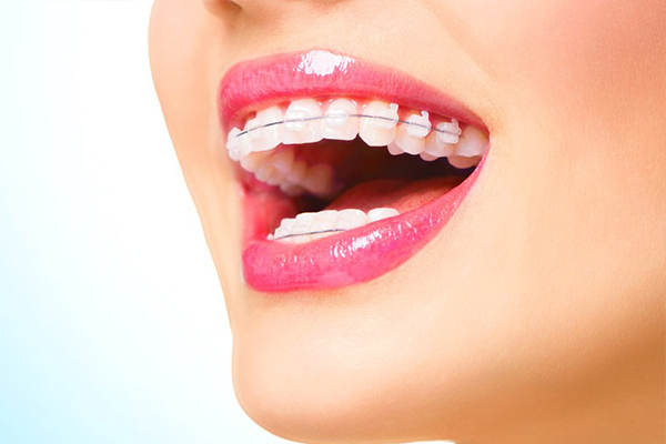 在合肥做冷光美白牙齿多少钱呢？