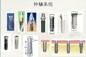 合肥种植牙可以使用多少年？