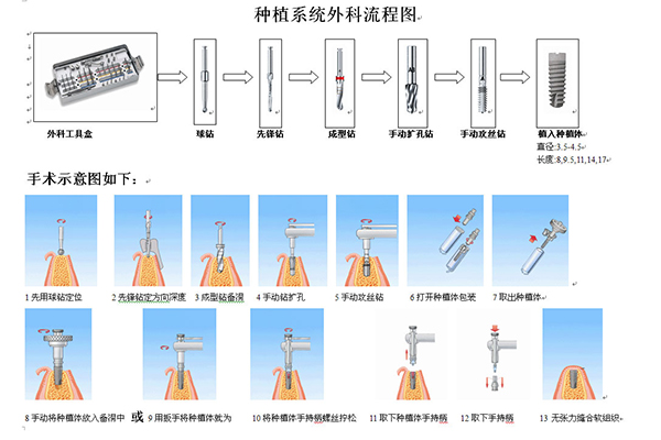 种植牙术后多久可以吃东西？