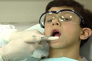 儿童牙齿为什么要做涂氟？