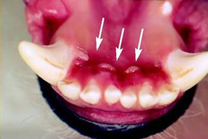 经常性牙龈出血是怎么回事？