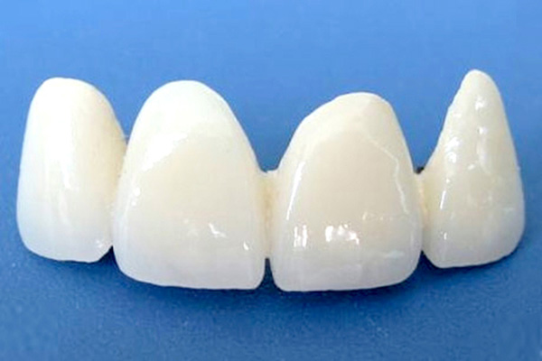 合肥的全瓷牙有哪些优越性能？