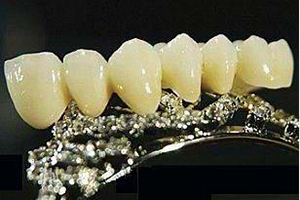 牙釉质发育不全症是什么