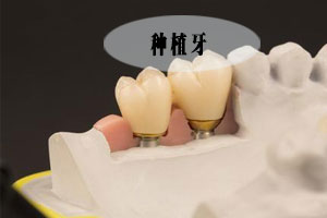 种植牙修复有哪些方面的优势？