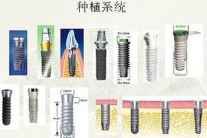  种牙齿修复过程需要多长时间