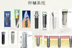 做种植牙适应情况有哪几种呢？