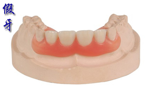 <b>牙齿修复用隐形义齿怎么样？</b>