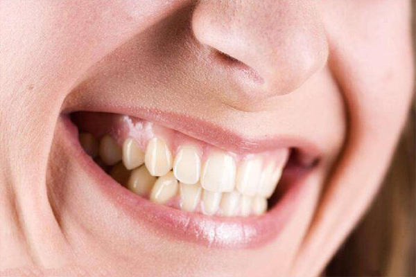 牙龈炎产生的原因是什么?