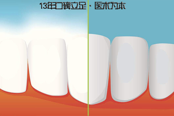 牙齿矫正对脸型的改变有好处吗?