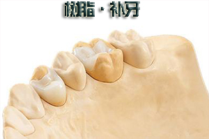 补牙过程是什么?