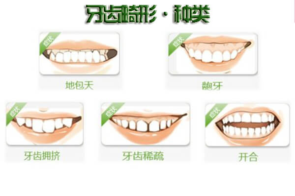 牙齿拥挤
