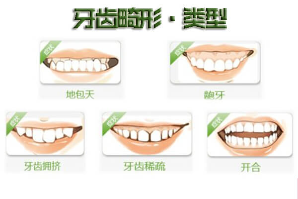 牙齿不齐戴牙套大概多少钱