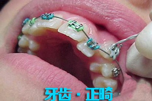 合肥牙齿矫正，合肥矫正费用