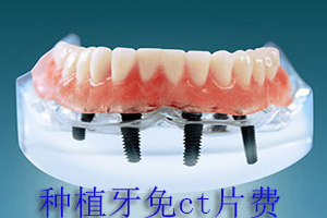 合肥镶牙多少钱？