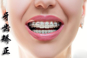 合肥牙齿整形多少钱？