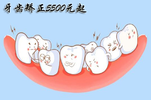 合肥成人矫正牙齿多少钱？
