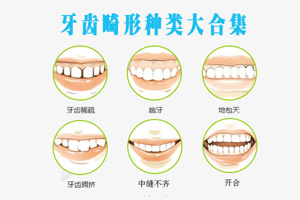 合肥牙齿正畸需要多少钱？