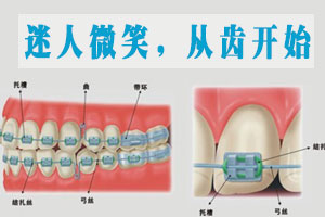 牙齿错位用什么方法较好？