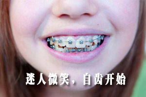 儿童牙齿矫正？