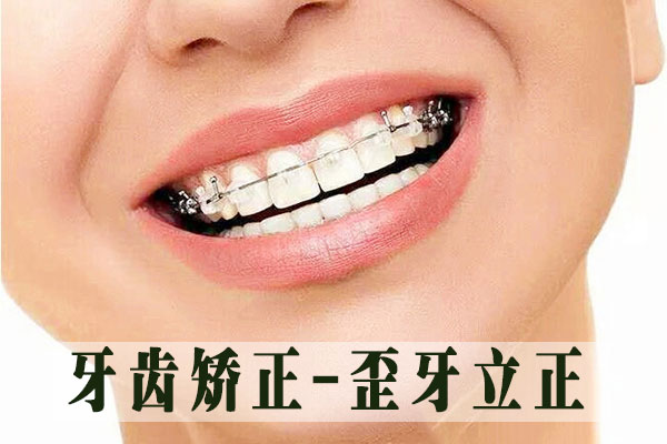 合肥牙科正畸牙科