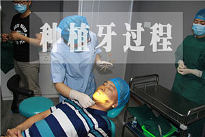 种植牙的手术过程？合肥佳德口腔种植牙详解