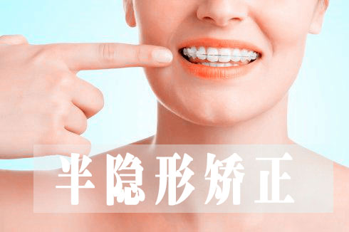 合肥牙齿畸形矫正要多少钱
