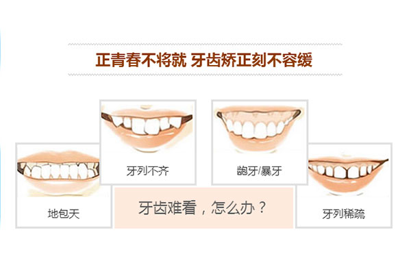 合肥牙齿正畸价格表？