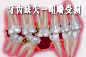 牙齿缺失的危害有哪些？