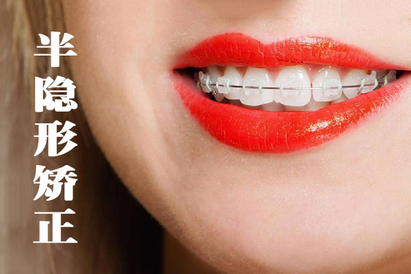 合肥牙齿矫正一般要多少钱