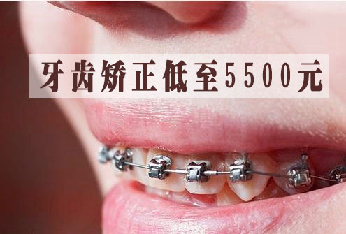 合肥一般矫正牙齿多少钱