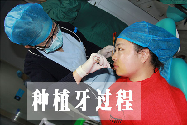 合肥哪家种植牙口腔医院好