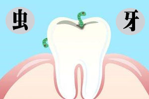 合肥蛀了牙补牙要多少钱？
