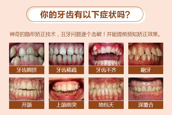 佳德口腔牙齿矫正速成班