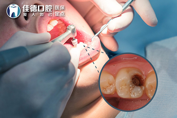 牙痛的常见症状表现都有哪些呢