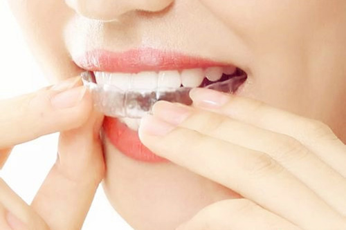 合肥25岁隐形矫正牙齿多少钱？