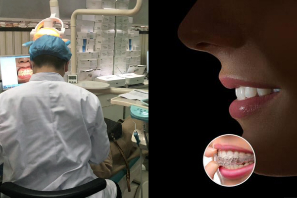 牙齿矫正技术