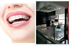 合肥做牙齿矫正哪家口腔好，收费怎么样？