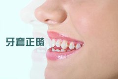 合肥牙齿矫正价格多少钱？