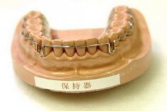 在合肥关于牙齿保持器你了解多少？